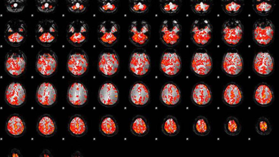 fmri brain scan 